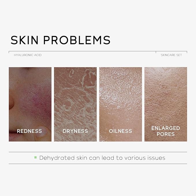 Hydrating Skin Care Set, Hyaluronic Acid Skin Care Kit with Serum for Face, Moisturizer, Travel Size Face Care Set for Women, Anti Aging Plumping Hydrating Firming for Dry Skin-VivaGrace Women