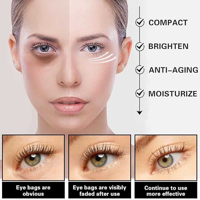 Eye Cream for Dark Circles Bags Eye Cream Eye Products Under Eye Bags Dark Circles-VivaGrace Women