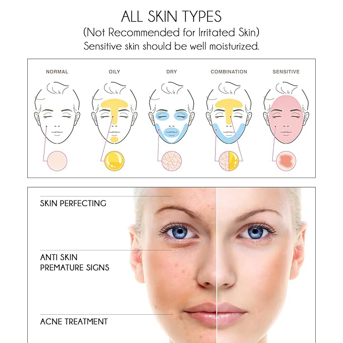 Pure Vitamin C Facial Serum with Salicylic Acid and Glycolic Acid, Anti-Wrinkle, Anti-Acne and Anti-Blackhead, Dark Spot Correcting, 7,5% AHA, Sebum Balance, ¾ oz-VivaGrace Women
