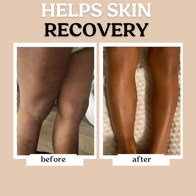 Roe Wellness- Baby Lotion Moisturizer Fragrance-Free | Great For Sensitive Skin Lightweight Moisturizing Lotion | For Babies, Infants, Kids and More-VivaGrace Women