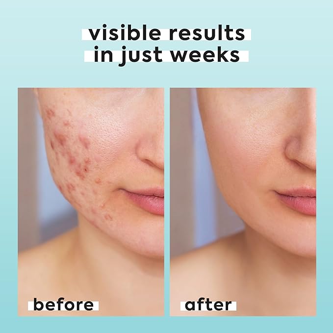 Hypochlorous Acid Spray for Face & Body - Helps Reduce Redness and Breakouts - Travel Size Hypochlorous Spray, Multi-Purpose Topical Facial Skin Repair, pH-Balancing Toner - TSA, Livaclean-VivaGrace Women