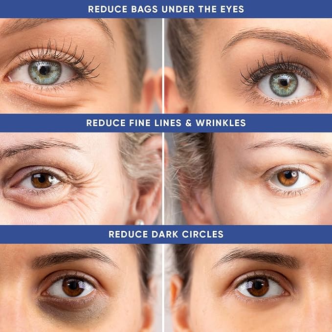 Instant Puffy Eye & Lift Treatment – Removes Under Eye Bags & Puffiness. Eliminate Dark Circles & Wrinkles. Naturally Ageless Hydrating Cream. Disappears Before Your Eyes Within Minutes.-VivaGrace Women