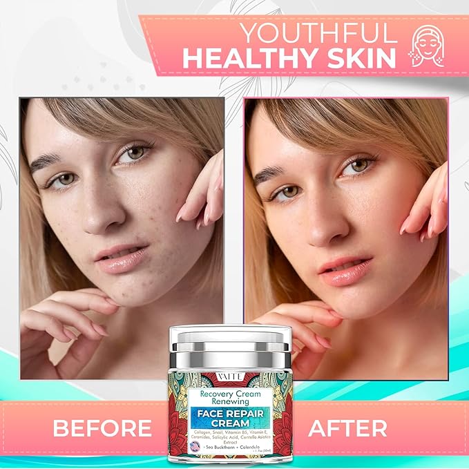 VAITE Face Moisturizer Remedy Skin Repair Cream with Snail, Salicylic Acid, Vitamin B5, Vitamin E, Collagen, and Ceramides for Men and Women Anti-aging Anti-wrinkle Made in USA Night and Day-VivaGrace Women
