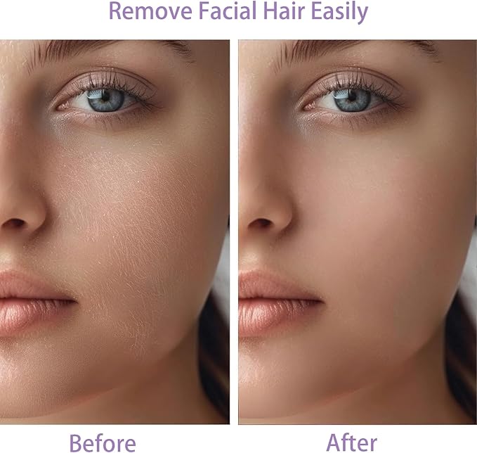 Women Facial Hair Removal Device Battery Operated with 2 Replacement Heads, Painless Womens Face Shaver for Chin Upper Lips Peach Fuzz-VivaGrace Women