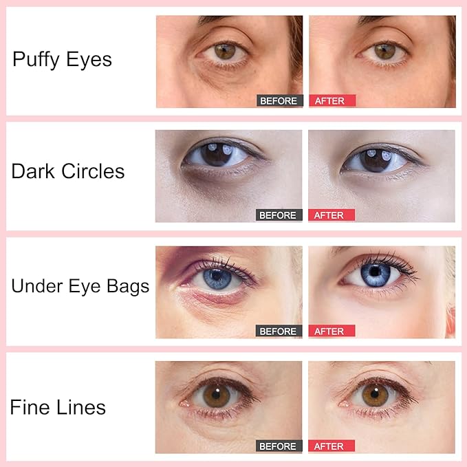 Retinol Eye Stick, Under Eye Cream Anti Aging Eye Brightener Stick, Retinol Brightening Eye Cream Retinol Eye Cream for Dark Circles and Puffiness, Wrinkles Hydrating Remove Eye Bags-VivaGrace Women