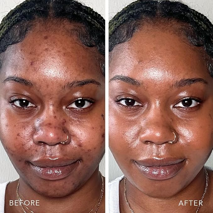 Doll 10 TCE Liquid Filter – CC Cream - Liquid Foundation - Lightweight Tinted Moisturizer & Skin Tint - Blurs Pores & Fine Lines - Vegan - Clean Makeup - [Tan/Deep] - 30 Day Supply-VivaGrace Women