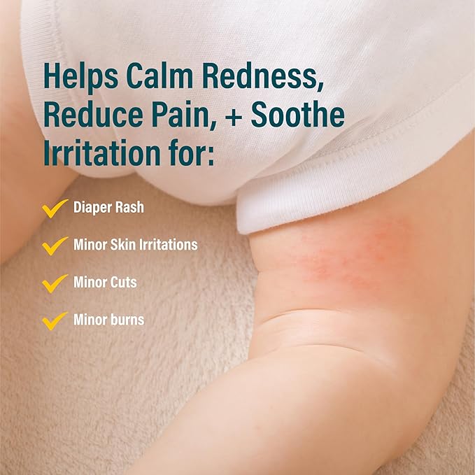 A+D Antimicrobial Hydrogel Spray – with Hypochlorous Acid, Removes Germs, Helps Heal Rashes & Irritations, Reduces Itch & Pain, Alcohol-Free, Non-Sting Formula, Safe for All Ages, 4oz-VivaGrace Women