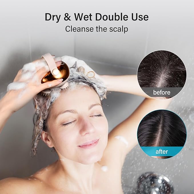 arboleaf Electric Scalp Massager Head Massager Scalp Stress Relax, 5 in 1 Kneading 128 Massage Nodes, Waterproof Hair Massage with 8 Removable Claws Cat Scratcher, Gift for Dad Mom-VivaGrace Women