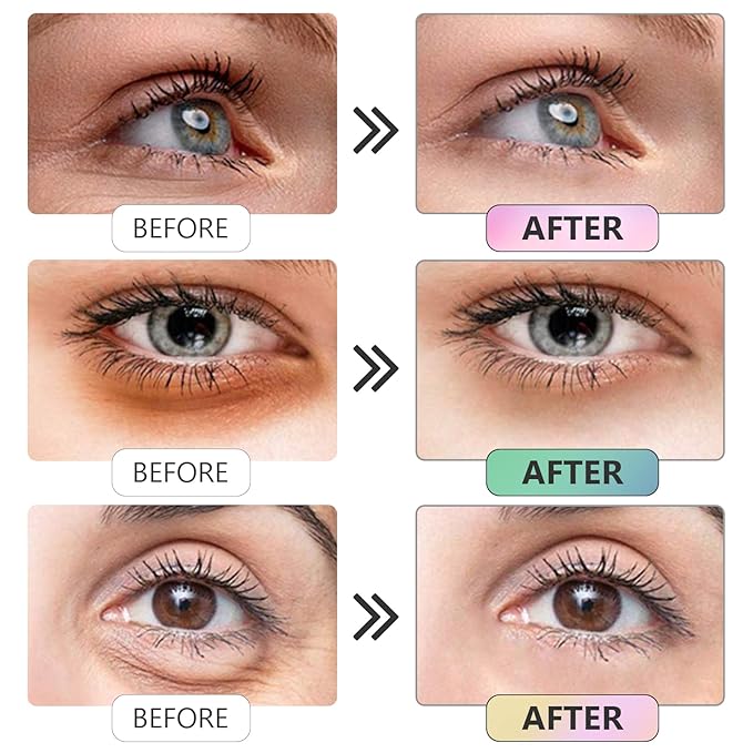 Under Eye Patches -30 Pairs Sakura Essence Eye Mask for Puffy Eyes,Reducing Dark Circles,Anti-Aging & Refreshing, Collagen Eye Mask for Moisturizing,Sakura Pink-VivaGrace Women