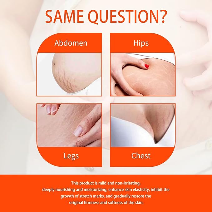 Stretch Mark Pregnancy Oil, Natural Oil Skincare Body Oil Serum for Scars and Stretch Marks, Face with Vitamin E & A for Sensitive Dry Skin and Body Moisturizer-VivaGrace Women