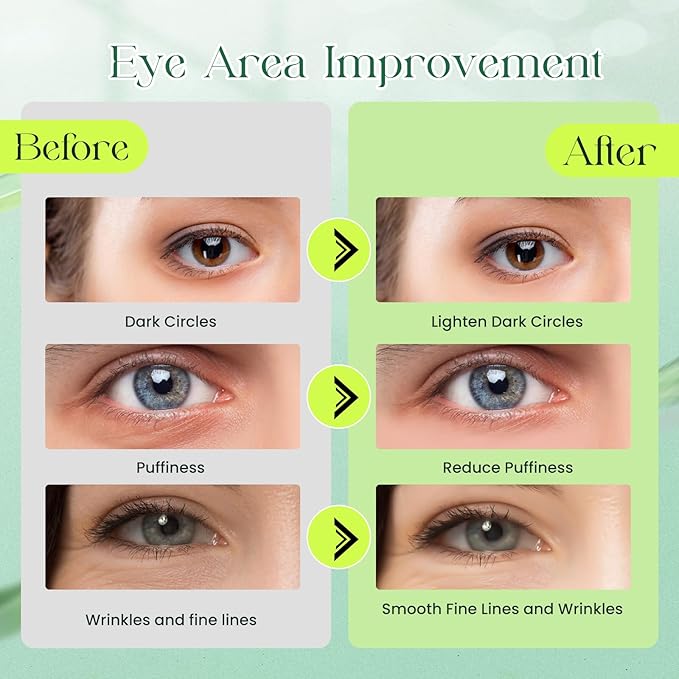 60 Pack Avocado Extract Eye Masks,Hyaluronic Acid Augenpads,Moisturising Eye Mask,Remove Dark Circles,Tear Bags,Wrinkles,Puffiness,Suitable for All Skin Types-VivaGrace Women