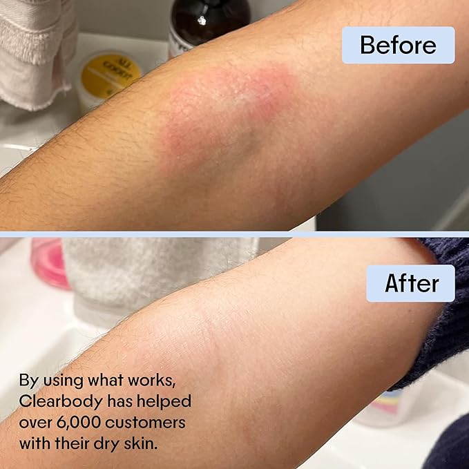 Clearbody Organics Colloidal Oatmeal Eczema Cream with Manuka Honey - 4 oz - Plant-Based Moisturizer & Eczema Ointment for Dry, Itchy Skin Relief-VivaGrace Women