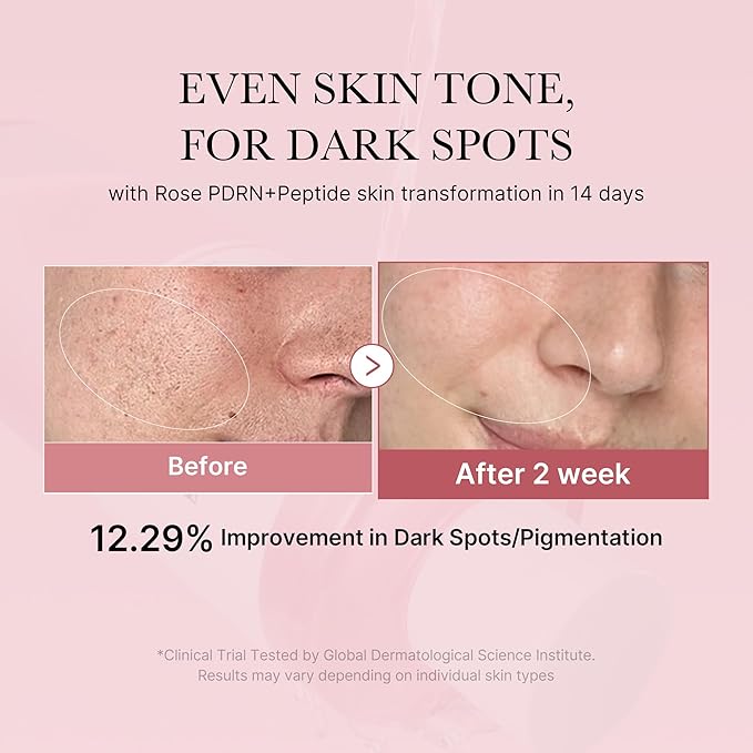 medicube PDRN Pink Peptide Toner I Pink Glow Toner for Skin Boosting, Soothing and Calming, Uneven Skin Tone, Rose PDRN & Peptide & Niacinamide, Korean Skin Care (250ml / 8.45 fl. oz.)-VivaGrace Women