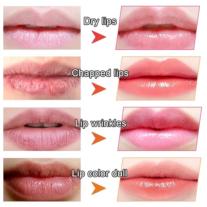 Adofect 30 Pieces Collagen Crystal Lip Masks, Collagen Lip Pads Great for Moisturizing, Remove Dead Skin, Anti Chapped & Anti-Aging and Plump Your Lips, Watermelom Red-VivaGrace Women