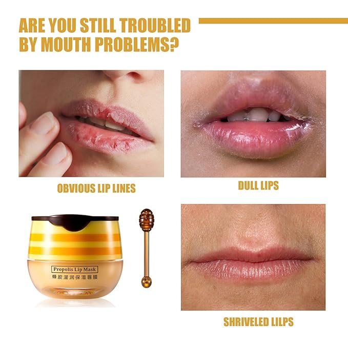 4Pcs Lip Balm Honey Pot, Propolis Moisturizing Honey Lip Mask Lip Balm, Reduces Lip Lines, Prevention Dry and Cracked Lip Scrubs Exfoliator. …-VivaGrace Women