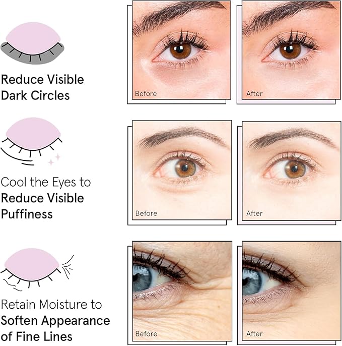 grace & stella Award Winning Under Eye Mask - Travel Essentials - Anniversary Gifts for Women - Gel Eye Patches for Dark Circles, Puffy Eyes, Wrinkles, Undereye Bags - Vegan Self Care (48 Pairs, Gold)