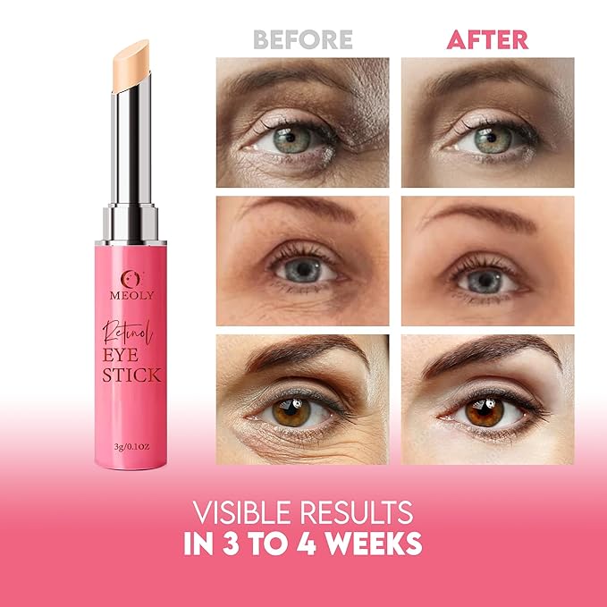 Instant Eye Bag Remover, Retinol Eye Cream for Dark Circles, Under Eye Brightener Stick, Under Eye Cream Anti Aging, Eye Cream for Wrinkles, Brightening Eye Cream for Puffiness and Bags-VivaGrace Women