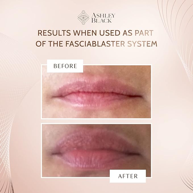Maximum Lip Plump by Ashley Black - Plump and Hydrate Lips Instantly-VivaGrace Women