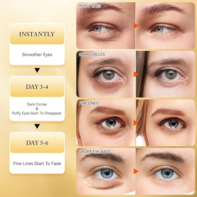 Under Eye Patches for Dark Circles and Puffiness, 60Pcs Under Eye Mask for anti Wrinkles & anti Aging, 24K Gold Eye Gel Pads with Collagen to Reduce Eye Bags, Puffy Eyes Treatment, Hydrating Eye Mask-VivaGrace Women