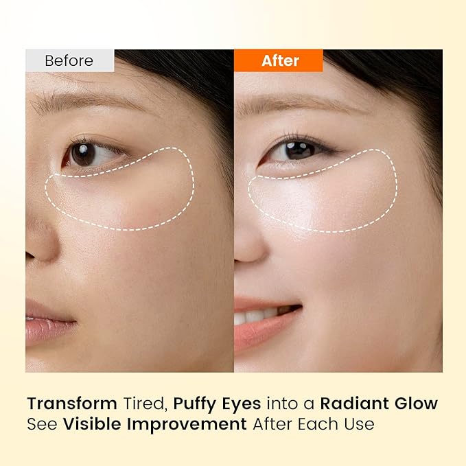 Caffeine Under Eye Patches: 30 Pairs Korean Hydrogel Eye Masks for Dark Circles Puffiness Relief with Niacinamide Hyaluronic Acid - Undereye Brightening Hydrating Anti-Wrinkle Treatment-VivaGrace Women