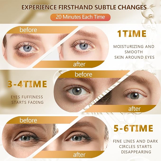 60 Pcs 24K Gold Under Eye Patches, 30 Pairs Undereye Mask for Dark Circles Puffy Eyes Treatment, Collagen Gel Pads Hydrating for Puffiness Wrinkle Eye Bags, Women Men Beauty Skin Care Products-VivaGrace Women