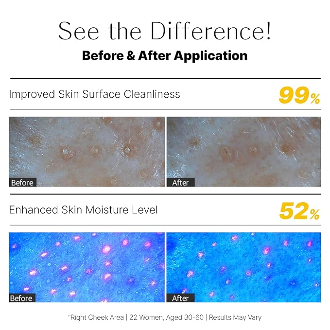 Lemon Honey Face Mask Wash-Off Pack & Scrub — 5-Minute, Exfoliating, Hydrating, Gentle for Sensitive Skin, with Manuka Honey & Lemon Extract, 3.52 oz (100 g)-VivaGrace Women