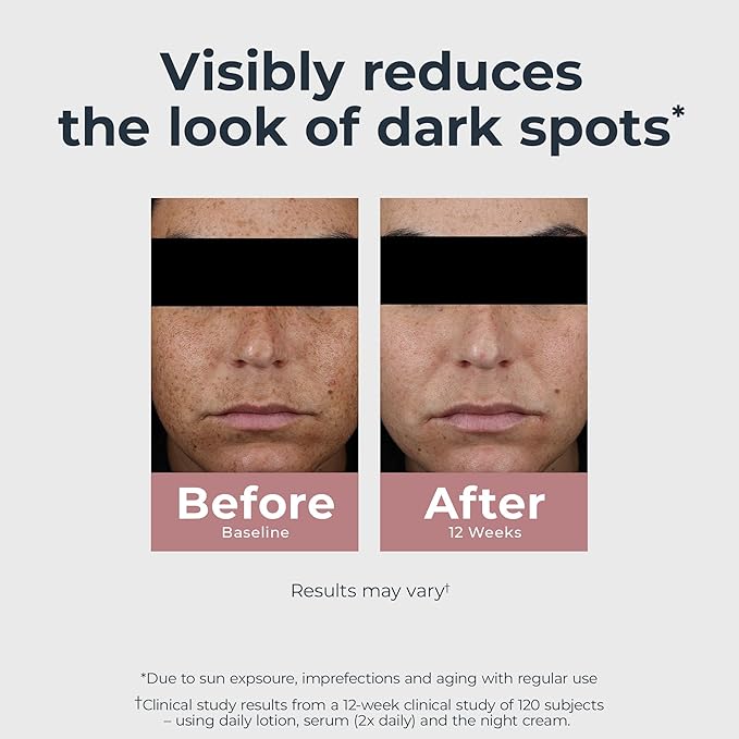 Eucerin Radiant Tone Night Cream, Dark Spot Corrector with Thiamidol, Night Moisturizer for Face Helps Visibly Reduce the Look of Persistent Dark Spots, All Skin Types, 1.7 Oz Bottle-VivaGrace Women