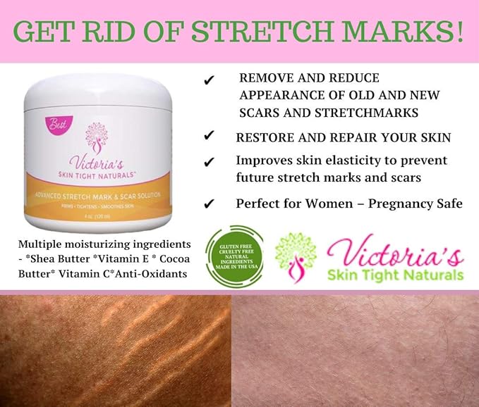 Best Stretch Marks Cream Prevent & Reduce Marks Reduce Pregnancy Stretch Marks Highly Concentrated Cream includes $29 Scar Reducing Guide-VivaGrace Women