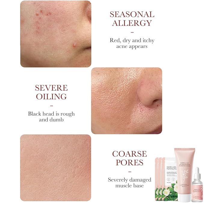 Camellia Extract Skin Care Sets, Skin Care Gift Set for Women Girls, Face Skin Care Routine Kit for Women, 5Pcs Skin Care Products Set with Cleanser,Mask, Face Serum-VivaGrace Women