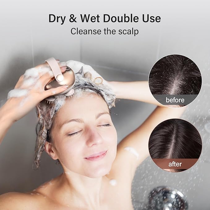 arboleaf Scalp Massager Kneading Head Massager Scalp Stress Relax Portable Rechargeable Hair Massager Shower Massage Waterproof Cat Massager Scratcher,Gift for Mom Dad-VivaGrace Women