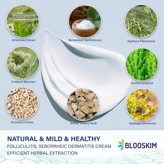 Seborrheic Dermatitis Face Cream – Face, Scalp & Body Moisturizing Treatment for Flaky, Itchy Skin – Daily Lotion for Psoriasis and Dermatitis Relief - Men and Women - 3.4 Fl Oz-VivaGrace Women