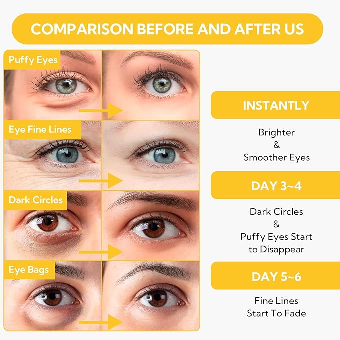 LANBENA 24K Gold Under Eye Patches(30 Pairs) -Cooling Eye Masks for Fine Lines Reduce, with Caffeine Niacinamide Tetrapeptide Hydra-Gel Collagen, Puffy Eyes & Dark Circles & Eye Bags Treatment-VivaGrace Women