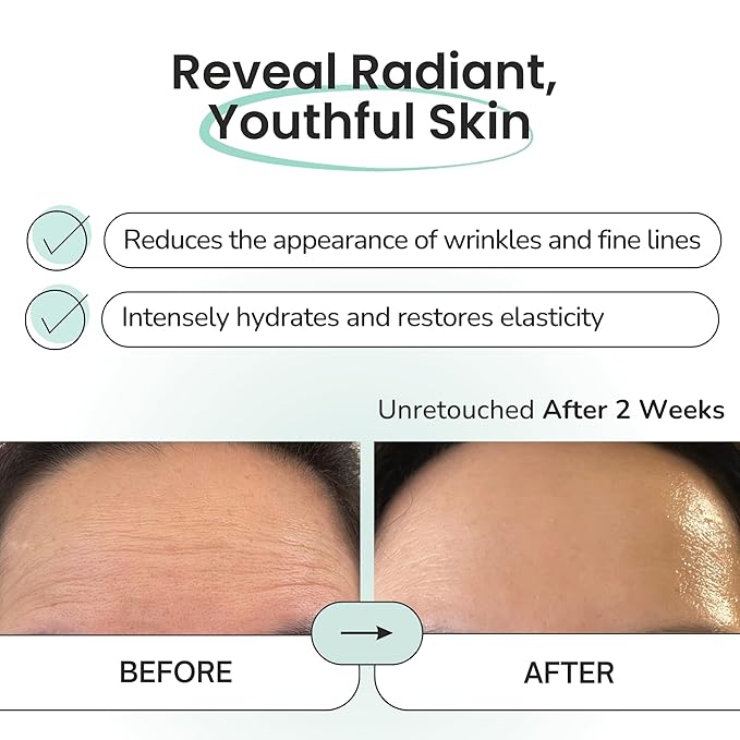 Advanced Forehead Wrinkle Patches Overnight - Anti Wrinkle Patches with Collagen, Peptides, Vitamin E - Strong Adhesion with Full Coverage for Forehead Wrinkles & 11 Lines, Made in Korea, 10 Count-VivaGrace Women