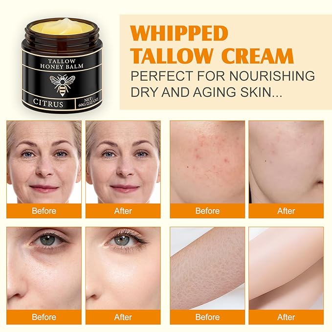 Tallow Honey Balm for Face Organic，Crema Cebo De Res Original，Handmade Tallow and Honey Balm for Face,Body，Sebo De Res Para La Cara，Based Supplies Tallow and Ho ney Bal m for Smooth Skin (2 Bottle)