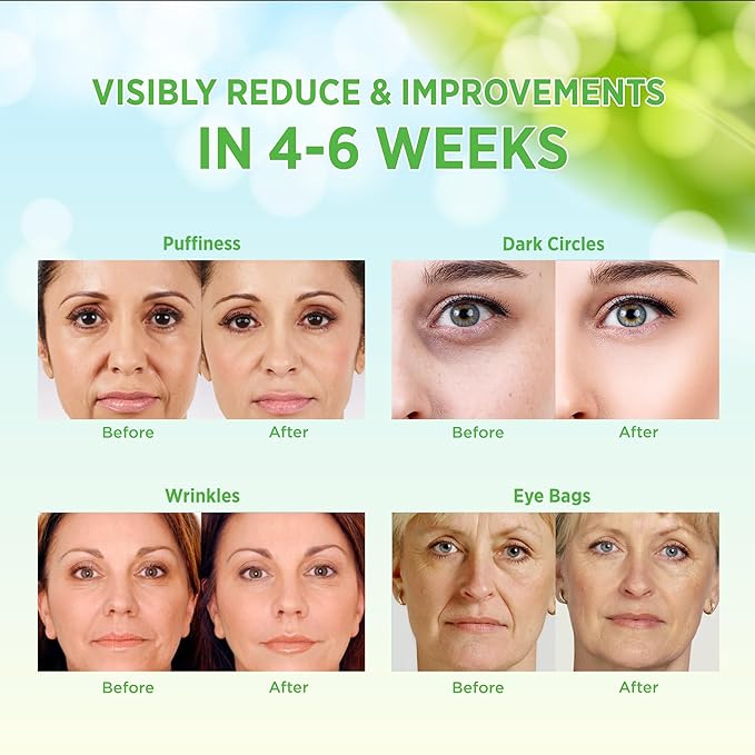 VELAMO ADVANCED Under Eye Patches: Aloe Vera Under Eye Mask for Dark Circles - Retinol Eye Patches for Wrinkles and Puffiness - Under Eye Bags Dark Circles Treatment for Women and Men 60 Pcs-VivaGrace Women