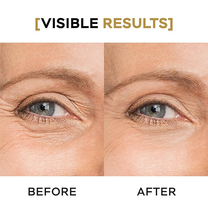 Moisturizing Eye Cream w/Aloe Vera, Collagen, Hyaluronic Acid, Cotton Stem Cells for Dark Circles, Puffiness & Bags - Under Eye Hydration Cream for Women & Men (1 Fl Oz)-VivaGrace Women