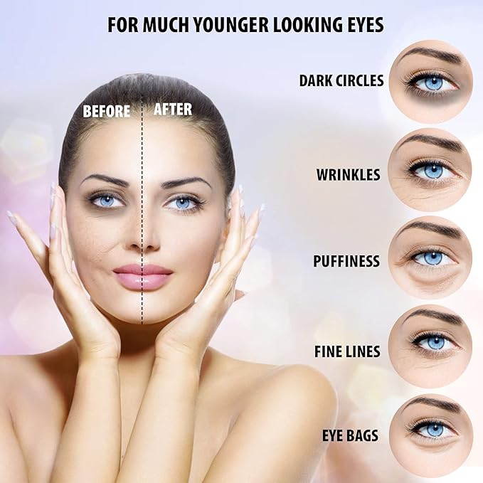 Under Eye Hydrogel E.G.F Eye Patches, 100% VEGAN CERTIFIED, Anti-Wrinkle Eye Patch, Treatment for Puffy Eyes, Eye Bags, Dark Circles Under Eye, Puffiness, Eye Patch with Hyaluronic Acid and-VivaGrace Women