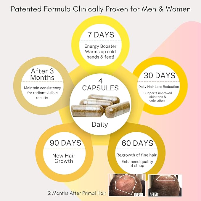 100% Natural Growth Treatment, Reduces Hair Loss, US Patented Formula Proven Effective for Men & Women, 100% Vegan Ingredients, Non-GMO, 30-Day Supply-VivaGrace Women