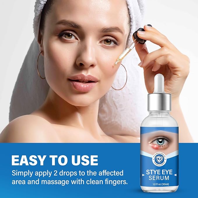 Stye Eye Treatment, Stye Eye Serum for Styes Chalazion and Blepharitis, Gently Cleanses Lashes and Eyes, Restore Healthier Eye Skin, 1 Fl.oz-VivaGrace Women
