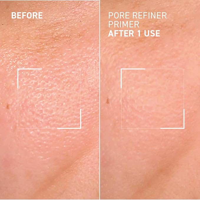 Dr. Brandt Pores No More, Pore Refiner Primer - Instantly Minimizes the Appearance of Pores, Absorbs Oil & Mattifies Shine - 1.0 fl oz-VivaGrace Women