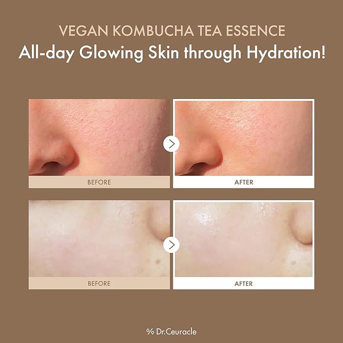Dr.Ceuracle Vegan Kombucha Tea Essence - Hydrating Milky Toner with Kombucha Tea Extract, Centella Asiatica, Ceramide, Korean Skincare (150 ml / 5.07 fl. oz.)-VivaGrace Women