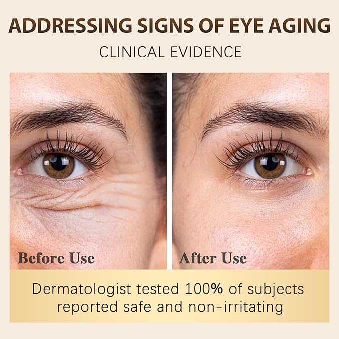 Vitality-Fill Boosting Eye Cream, Natural Anti Aging Under Eye Cream Lift & Firm,Reduce Wrinkles,Fine Lines,and Under Eye Bags,Dark Circles Under Eye Cream-VivaGrace Women