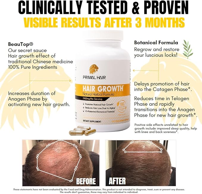 100% Natural Growth Treatment, Reduces Hair Loss, US Patented Formula Proven Effective for Men & Women, 100% Vegan Ingredients, Non-GMO, 30-Day Supply-VivaGrace Women
