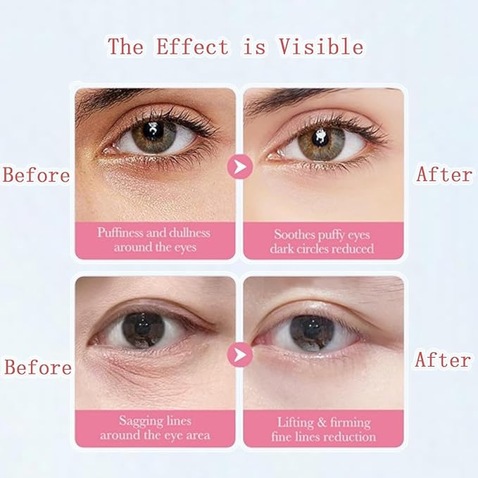 Under Eye Patches for Dark Circles, Puffiness and Eye Bags, Eye Mask,Wrinkle Treatment Anti-Aging Rejuvenating Moisturizing Skin Care 60PCS Collagen Eye Gel Pads Anti-Wrinkle Eye Patches-VivaGrace Women