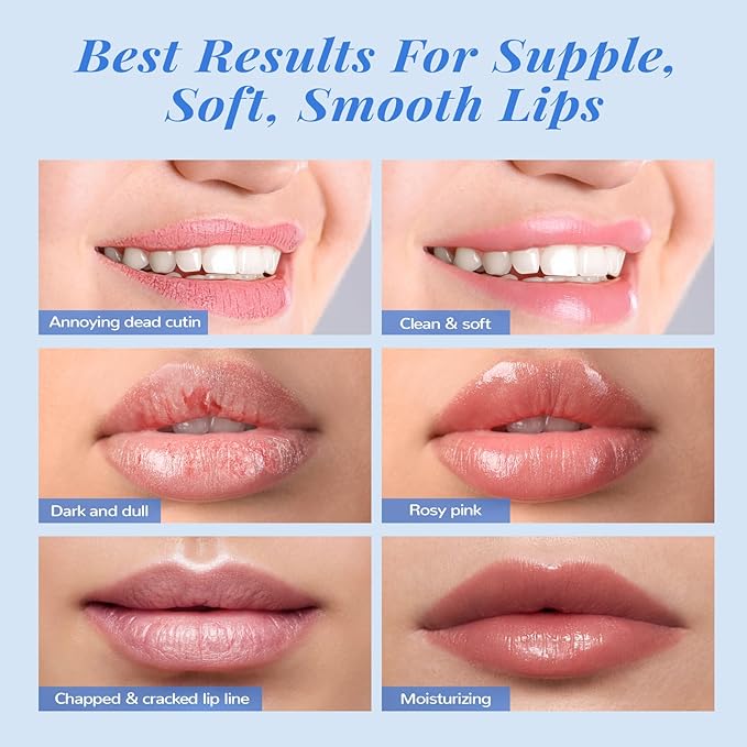 ANAI RUI Lip Therapy Set, Lip Scrub & Lip Mask, Overnight Moisturizing Lip Care Kit, Suagr Lip Exfoliator and Lip Sleeping Mask for A Soft Lips, Lip Gift Set for Dry, Chapped, Dark Lips, Blueberry-VivaGrace Women