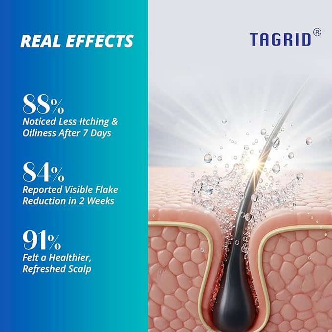 TAGRID Anti-Fungal Shampoo 300mL – Scalp Treatment for Psoriasis, Seborrheic Dermatitis, Folliculitis, Dandruff & Itchy Flaky Scalp – Soothing Plant-Based Formula for Men & Women-VivaGrace Women