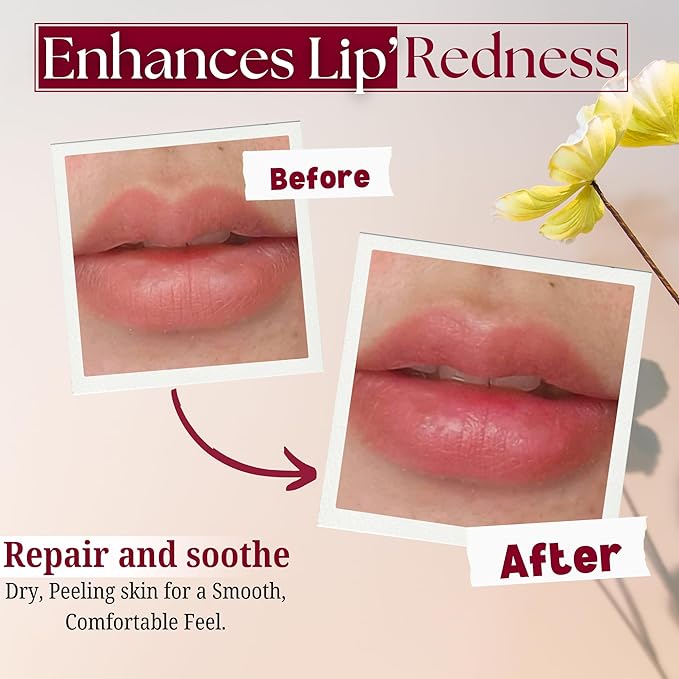 Merlena Pink Lip & Nip Serum - Hydrates and Repairs Dry, Peeling Lips and Nipples, Adds Collagen for Plumpness, Soothes Flaky Skin, Organic Vitamin C & E Formula 8ml-VivaGrace Women