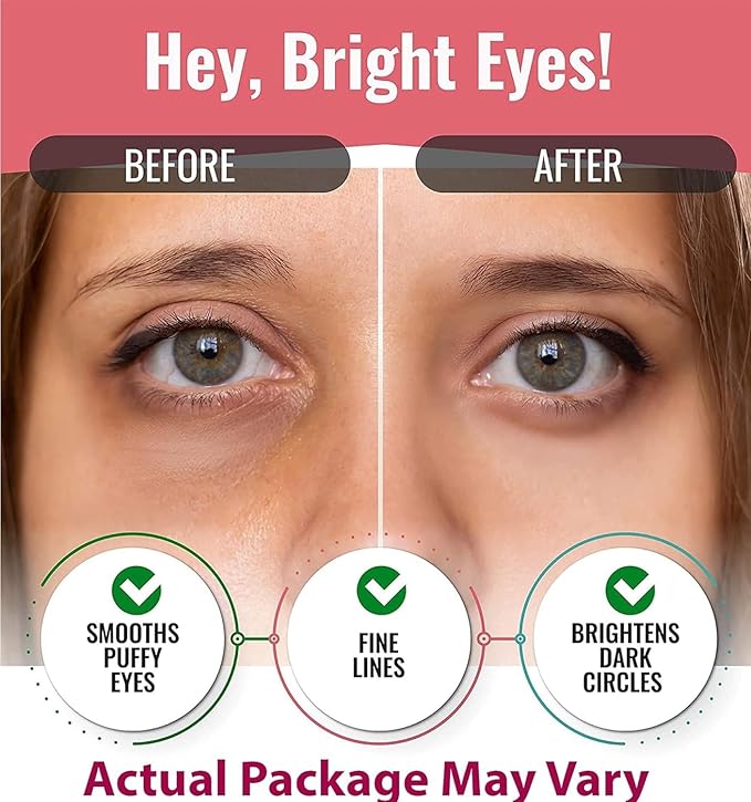 Hydro-gel Eye Patches (Combo)-VivaGrace Women