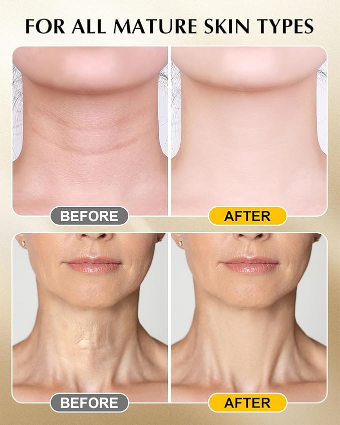 Neck Firming Cream with 3% Retinol - Hyaluronic Acid, Anti-Wrinkle Treatment, Skin Tightening Cream for Face, Neck, Chest & Décolleté-VivaGrace Women