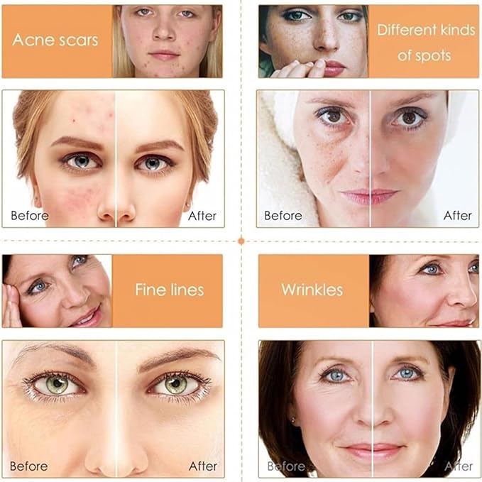 Vitamin C Skin Care Sets, 6Pcs Skin Care Products Set, Skin Care Gift Set for Women Girls, Hydrating Skincare Routine Set, Face Care Kit Includes Cleanser, Mask, Face Serum, Toner, Cream-VivaGrace Women